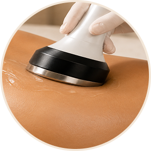 Ultrasonic Cavitation